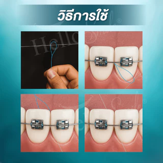 Hellosmile ห่วงร้อยไหมขัดฟัน 50เส้น พร้อมกล่องใส่ เส้นร้อย ห่วงนำ ไหมขัดฟัน คนจัดฟัน ทันตกรรม ช่องปาก
