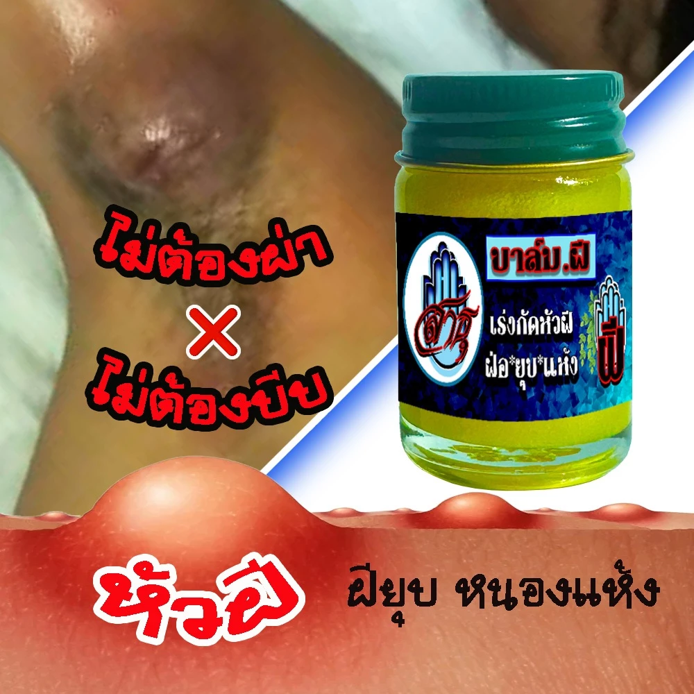 จบทุกปัญหาฝี! บนผิวหนังคุณ บาล์มฝีสาธุ