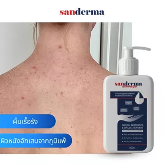 Sanderma เจลอาบน้ำ สูตรอ่อนโยน ฟื้นฟูผิวแพ้ง่าย ลดการอักเสบ ระคายเคืองและรอยแดง 300g