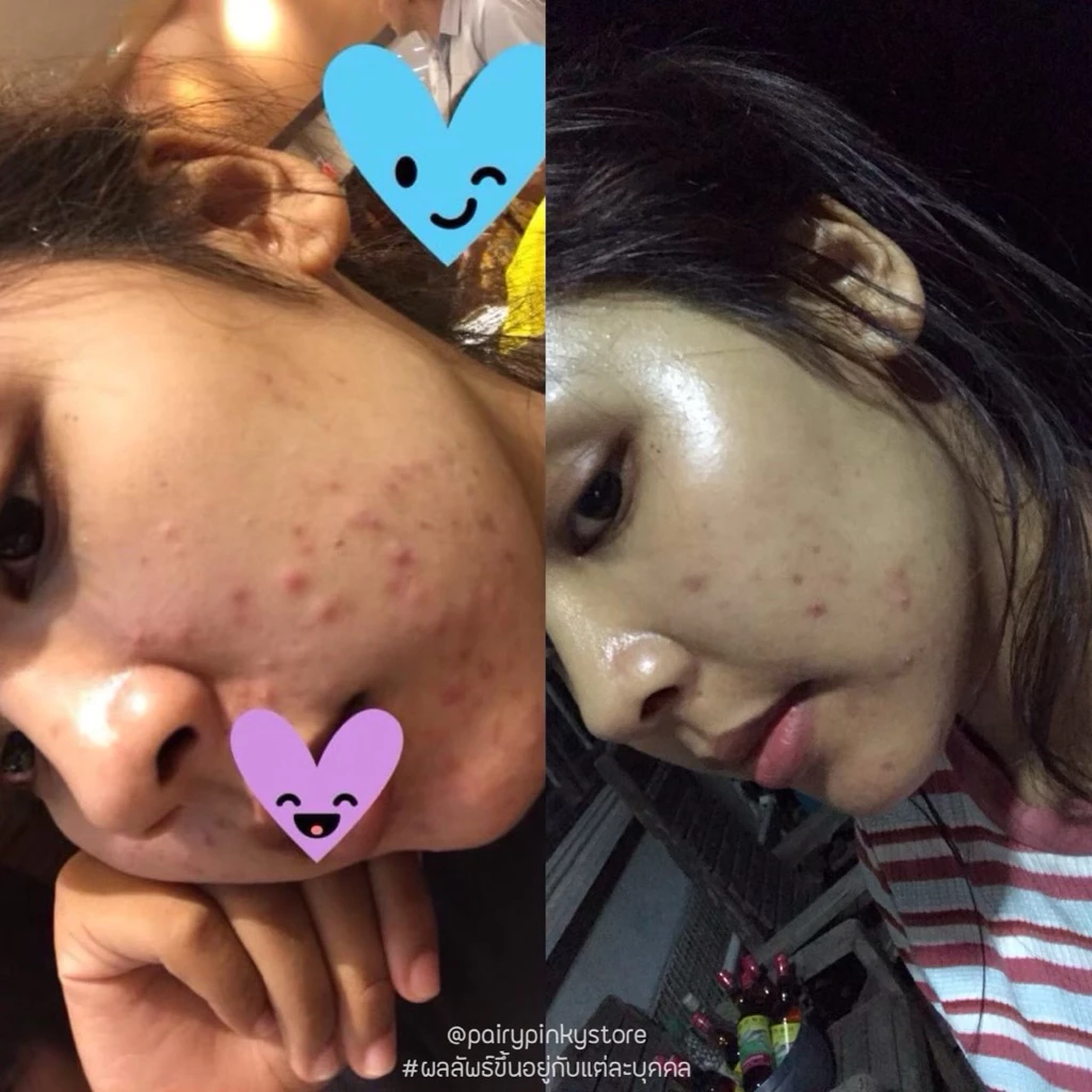 (พร้อมส่ง✅พาร์ทเนอร์บริษัท) สมุนไพรกาญจนา สมุนไพรไทย มาร์กสมุนไพร มาส์กสมุนไพร thumbnail 5