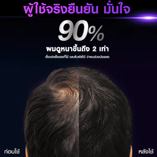 เคลียร์ เมน เซรั่ม สกาล์ปโปร แอนตี้แฮร์ฟอล 70 มล. เซรั่ม ลดผมขาดหลุดร่วง CLEAR Men Serum Scalp Pro Anti Hair Fall 70 ml.