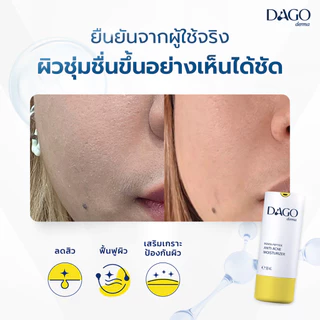 [Set 2 ชิ้น] มอยเจอร์ไรเซอร์ คุมมัน Dagoderma ลดรอยสิว ชุ่มชื้นยาวนาน Penta-Peptide Anti Acne Moisturizer 30ml.