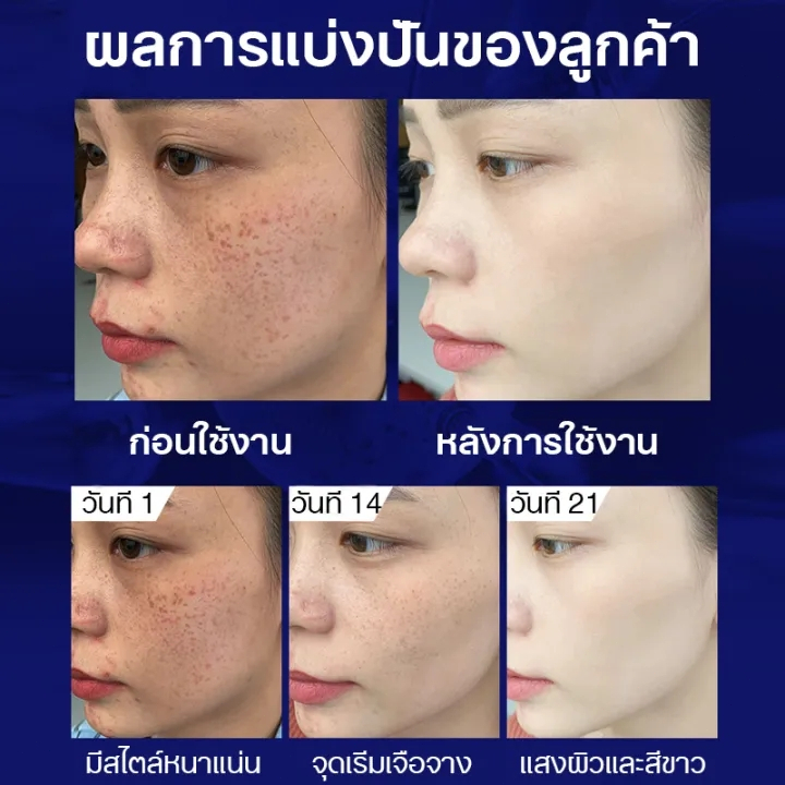 ครีม หน้า ขาว ครีมทาฝ้า ครีมแก้ฝ้า สารสกัดพืช 100% ขจัดฝ้า กระ จุดด่างดำ ลดริ้วรอย และให้ความชุ่มชื้นแก่ผิว - รูปที่ 4