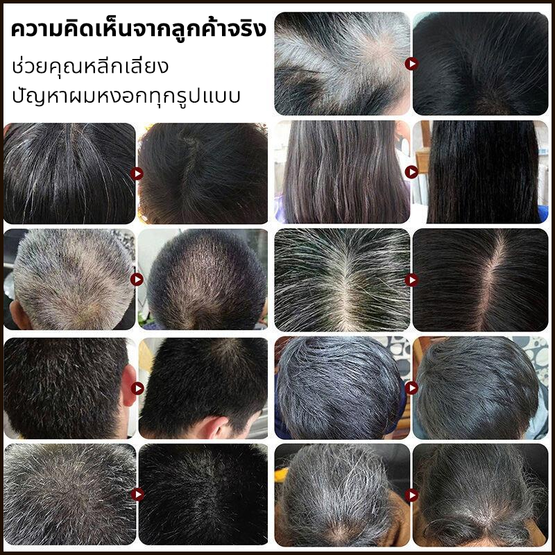 สเปรย์ปลูกผม ลดผมร่วง เพิ่มผมหนา กระตุ้นรากผม เร่งผมขึ้น แก้ผมบาง 100ml - รูปที่ 2