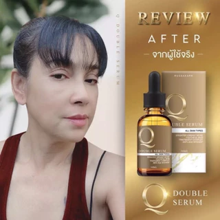 Q Double Serum เซรั่มคิวเข้มข้น 1 ขวด (30ml)