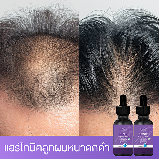 เซรั่มลดผมร่วง เซรั่มแฮร์โทนิค ปลูกผม ปลูกคิ้ว ผมยาวไว 1แถม1   โทนิคชบาสูตรเข้มข้นขึ้นเร็วของแท้100%