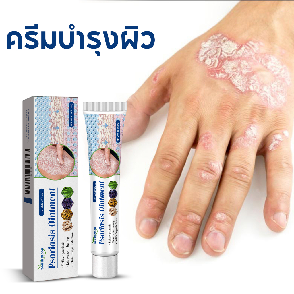 【ซื้อ 1 แถม 1】บาล์มบํารุงผิว South Moon สำหรับทาภายนอก ผิวแห้งและคันสูตรธรรมชาติ 20g