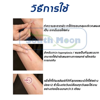 【จัดส่งจากกรุงเทพฯ】South Moon รักษารอยแผลเป็น แผ่นแปะแผลเป็น 4cm*150cm กําจัดรอยแผลเป็นจากแผลเป็น เผยผิวเนียนสวย
