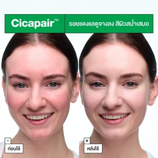 Dr.Jart+ Cicapair Soothing Color Correcting Treatment 55/15 ml | Instant Conceal Redness |