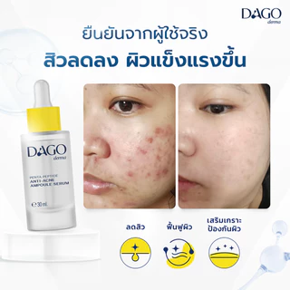 [Set 2 ชิ้น] เซรั่มลดสิว Dagoderma ลดรอยสิว ผลัดเซลล์ผิว Penta-peptide Anti Acne Ampoule Serum 30ml.