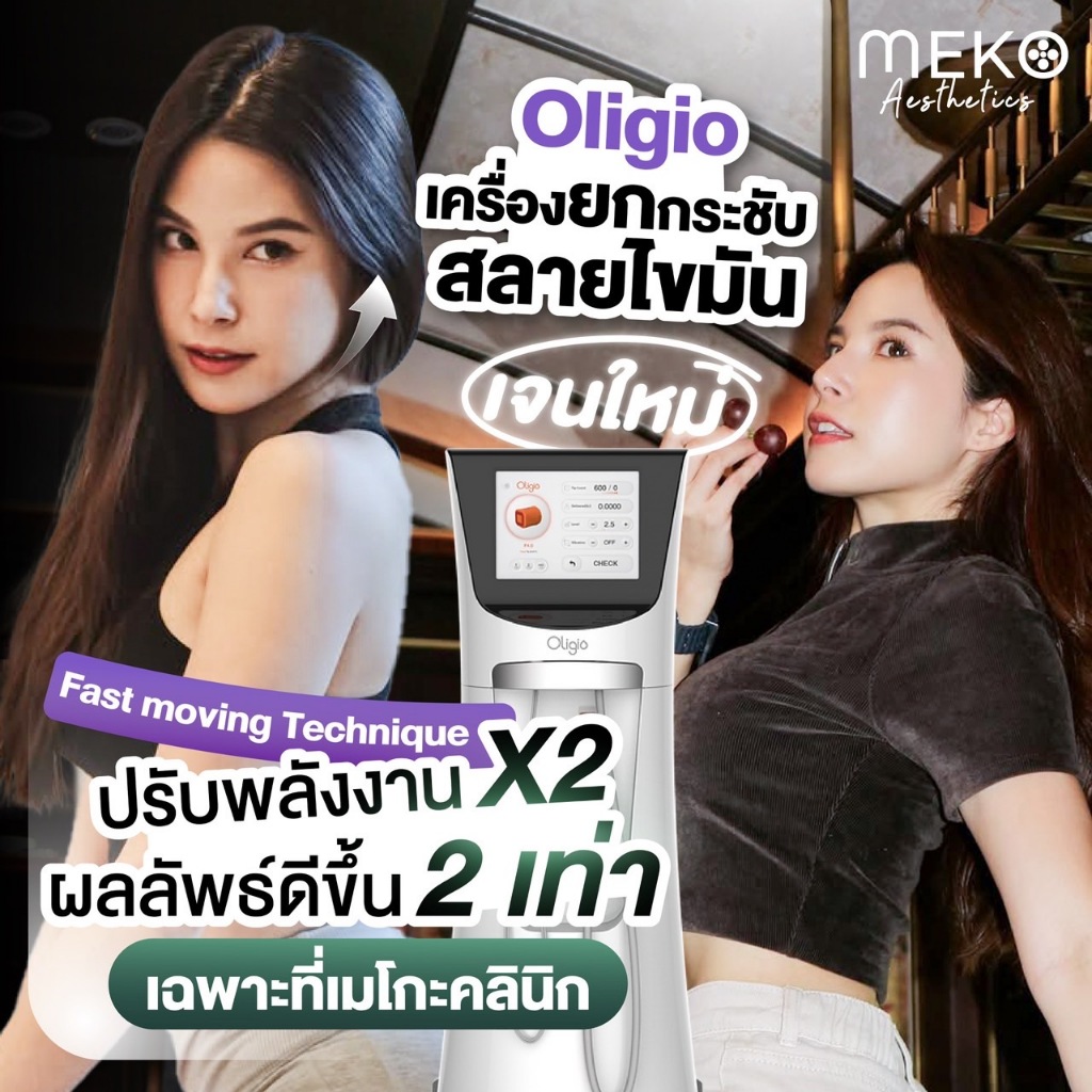 Oligio ยกกระชับ สลายไขมัน ให้หน้าเรียว ยกกระชับอ่อนวัย