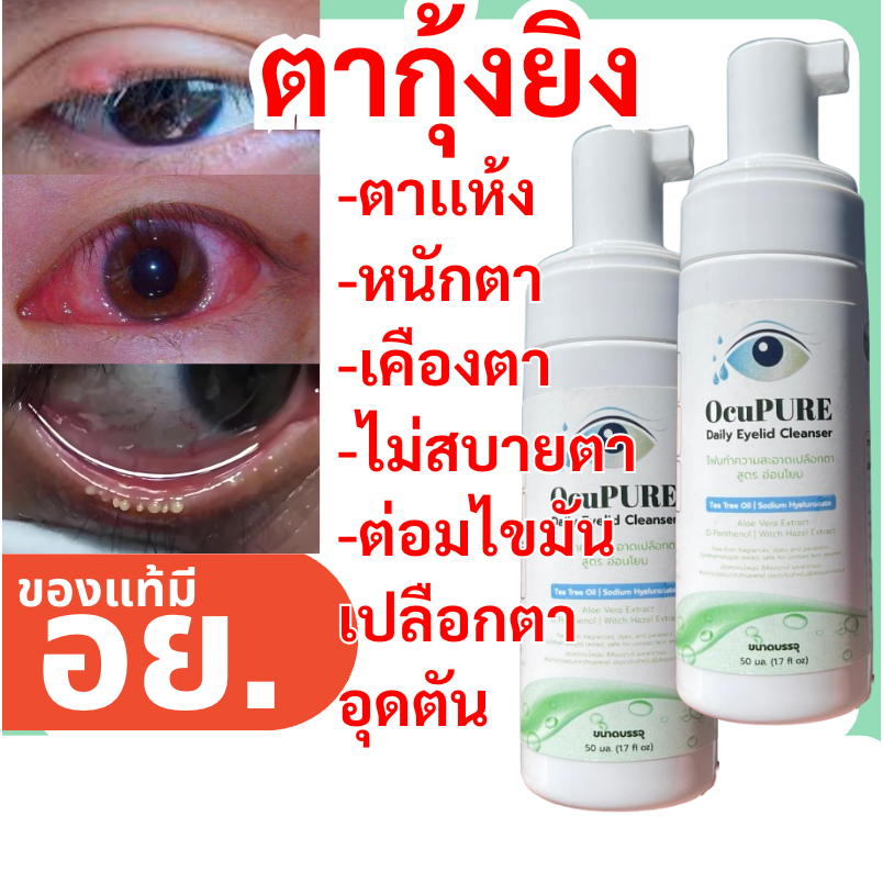 OcuPURE ทำความสะอาดเปลือกตา ขอบตา โคนตา Lid & Lash Soft Cleansing 2 ขวด