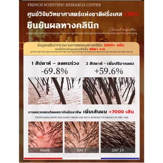 ⚡ของแท้⚡แชมพูปลูกผม แชมพูแก้ผมร่วง แชมพูขิง บำรุงหนังศีรษะ สดชื่น อ่อนโยน ไม่ระคายเคือง เร่งการเติบโตของผม ป้องกันผมร่วง