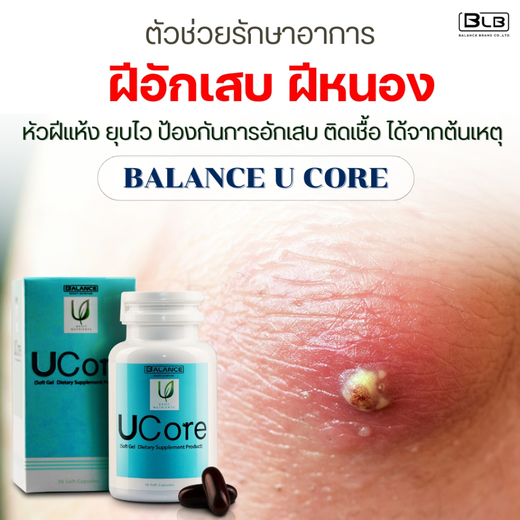 สมุนไพรฝีอักเสบ ฝีหนอง ดูแลด้วย Balance UCore | ของแท้ 100% ส่งจากบริษัทเองโดยตรง