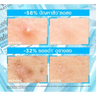 GARNIER - Skin Naturals Micellar Cleansing Water Salicylic BHA (125 ml.) คลีนซิ่ง