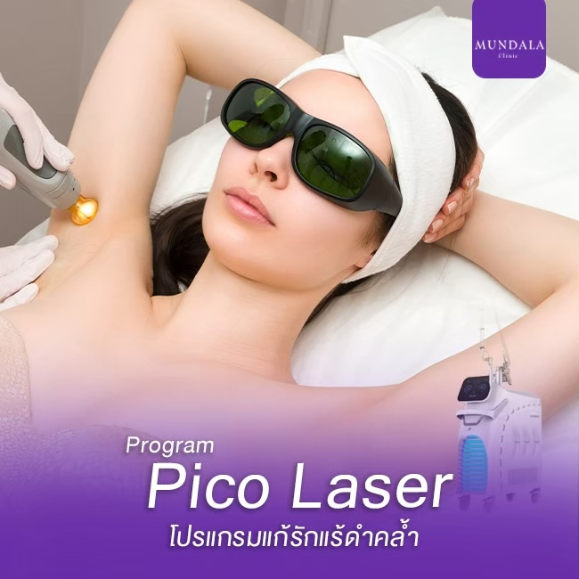 Pico Laser Program เลเซอร์รักแร้แก้ดำ คล้ำ