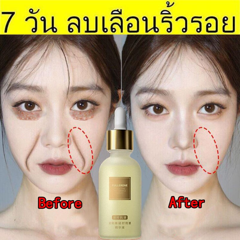 เซรั่ม กระชับ เซรั่มหน้าใส นริ้ว รอย ตีนกา ริ้วรอยริ้ว เซรั่มต่อต้านริ้วรอย อุดมไปด้วยกรดไฮลูโรนิก ไวท์เท 30ml