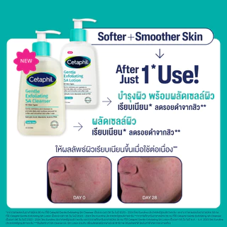 [แพ็คคู่] เซตาฟิล Cetaphil Gentle Exfoliating SA Cleanser เจลล้างหน้า สำหรับผิวไม่เรียบเนียน เป็นสิว ผิวแพ้ง่าย 473ml