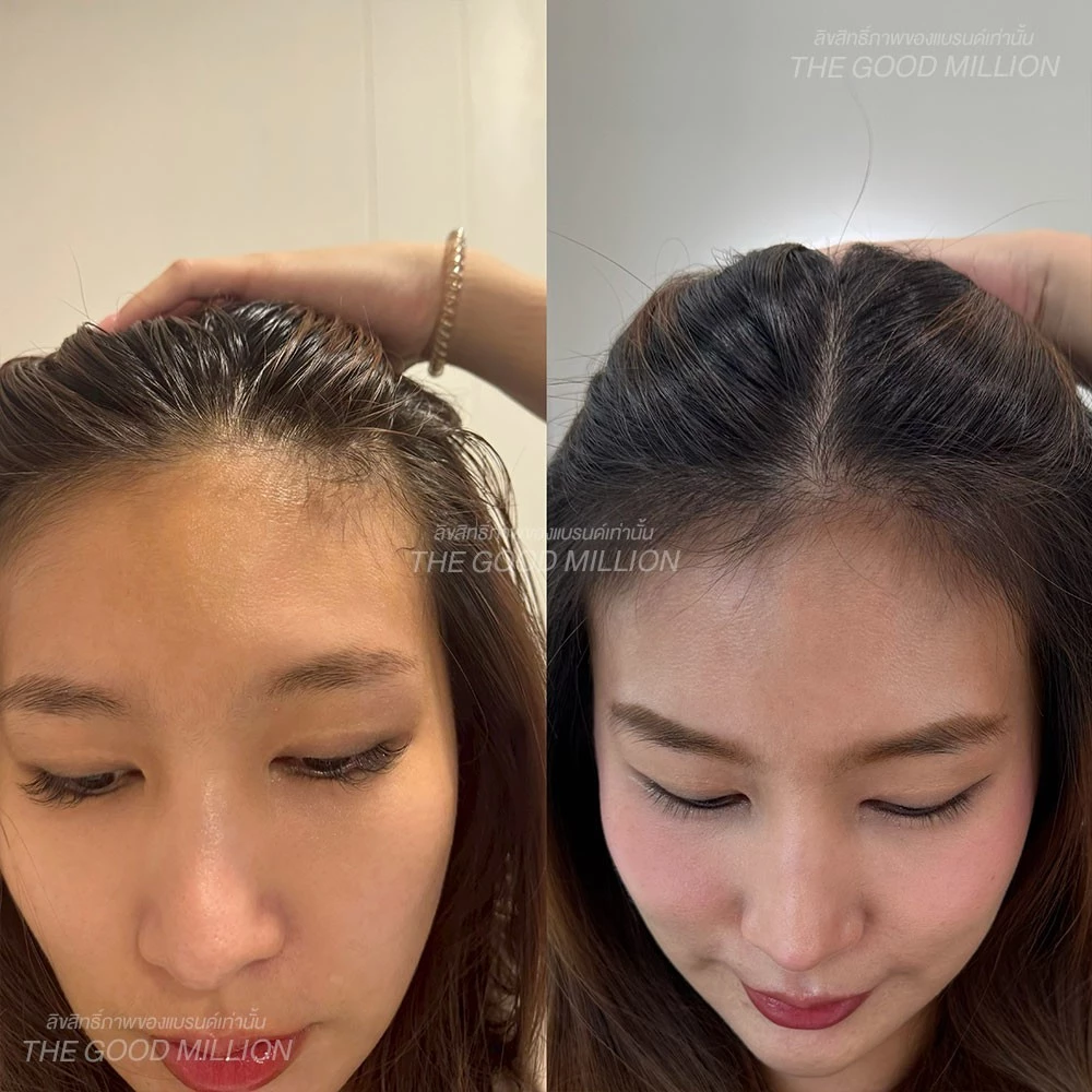 Hair Serum เซรั่มบำรุงผม นวัตกรรม 3 สูตรเพื่อผมสวยครบมิติ ฟื้นฟูผม เร่งผมยาว ผมหนา ผมสวย โคนจรดปลาย thumbnail 8