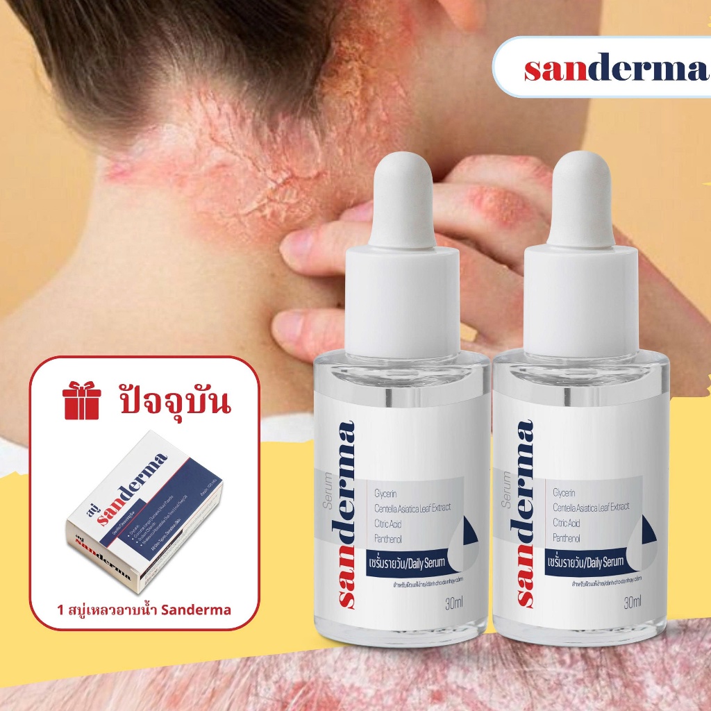COMBO 2 ไห SERUM บรรเทาอาการคัน SANDERMA 30ML