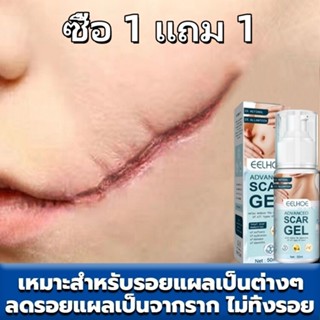 【1 แถม 1】EELHOE ครีมทารอยแผลเป็น50ML รักษารอยแผลเป็น แผลผ่าต…