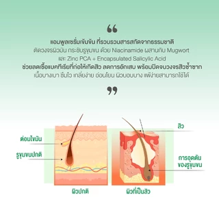 AM HERB POWERFUL B+ AMPOULE SERUM เซรั่มลดสิว รอยสิว คุมความมัน กระชับรูขุมขน ป้องกันสิวเกิดใหม่