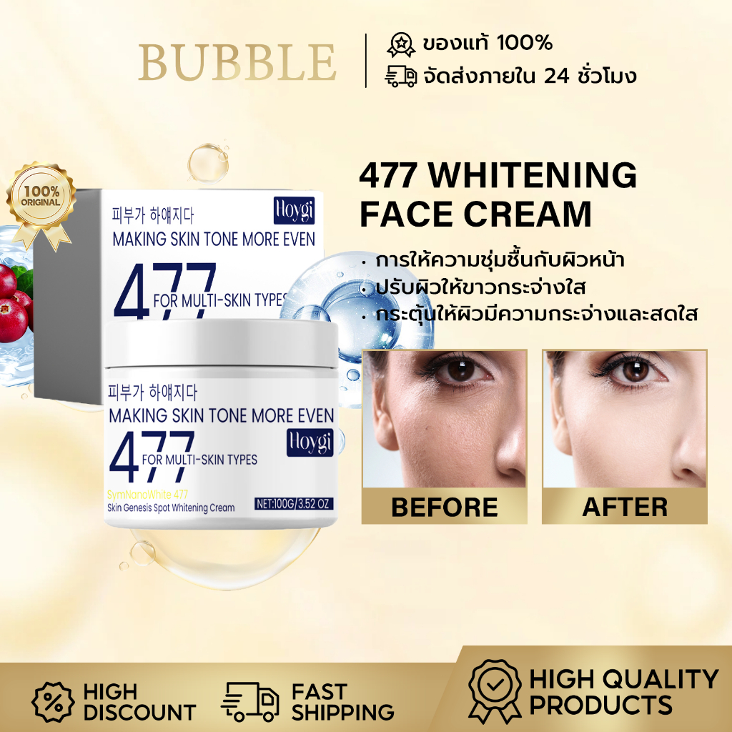 Hoygi 477ครีมถาหน้าขาว ครีมทาผิวโคจิก ครีมลบจุดด่างดํา กำจัดฝ้า จุดด่างดำ ฝ้า กระ กระจ่างใสผิว