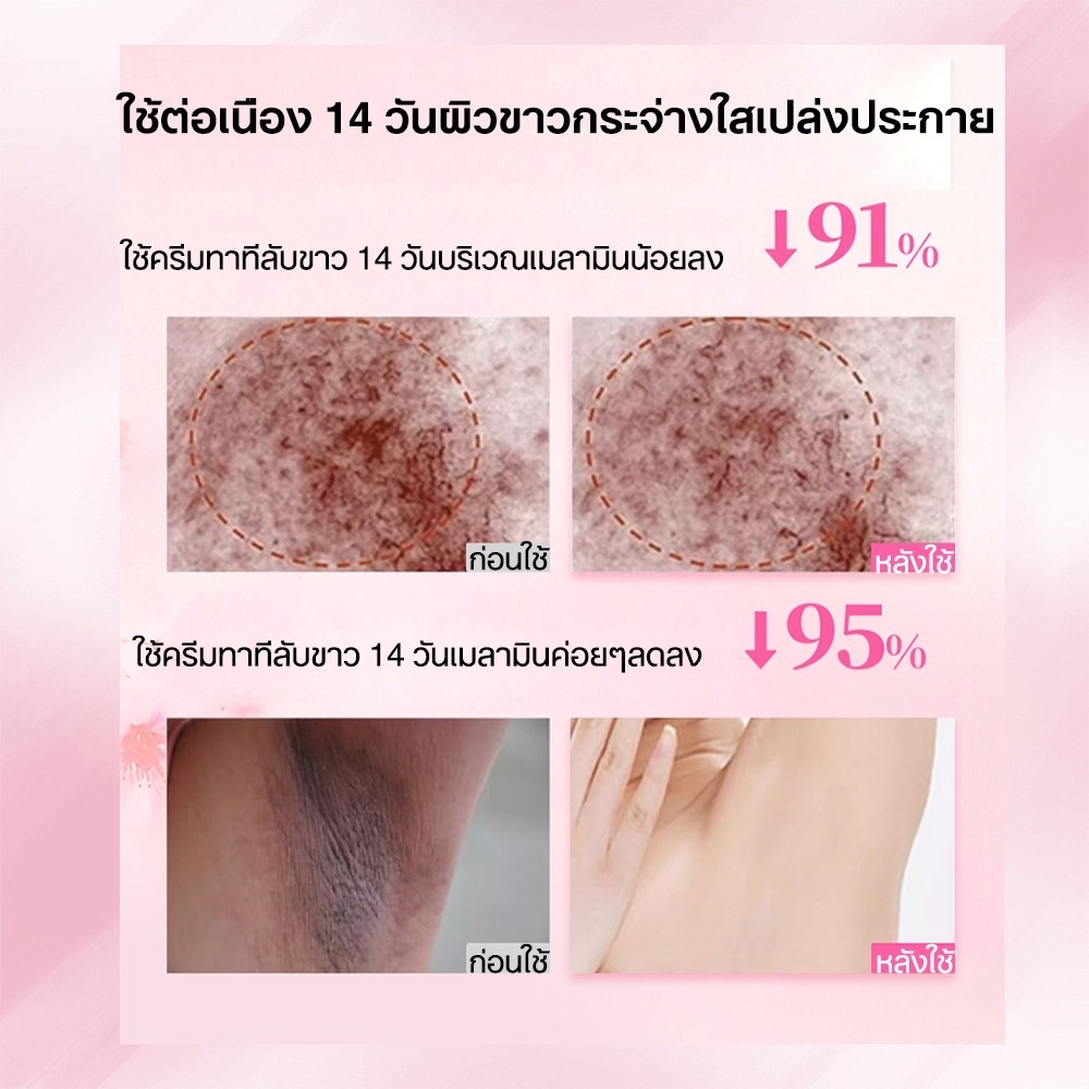 ครีมทาผิวขาว ครีมไวท์เทนนิ่ง ครีมบำรุงรักแร้ 100g ก้นดำ รักแร้ดำ ขาหนีบดำ สิวหลัง หัวเข่าดำ ศอกดำ - รูปที่ 3