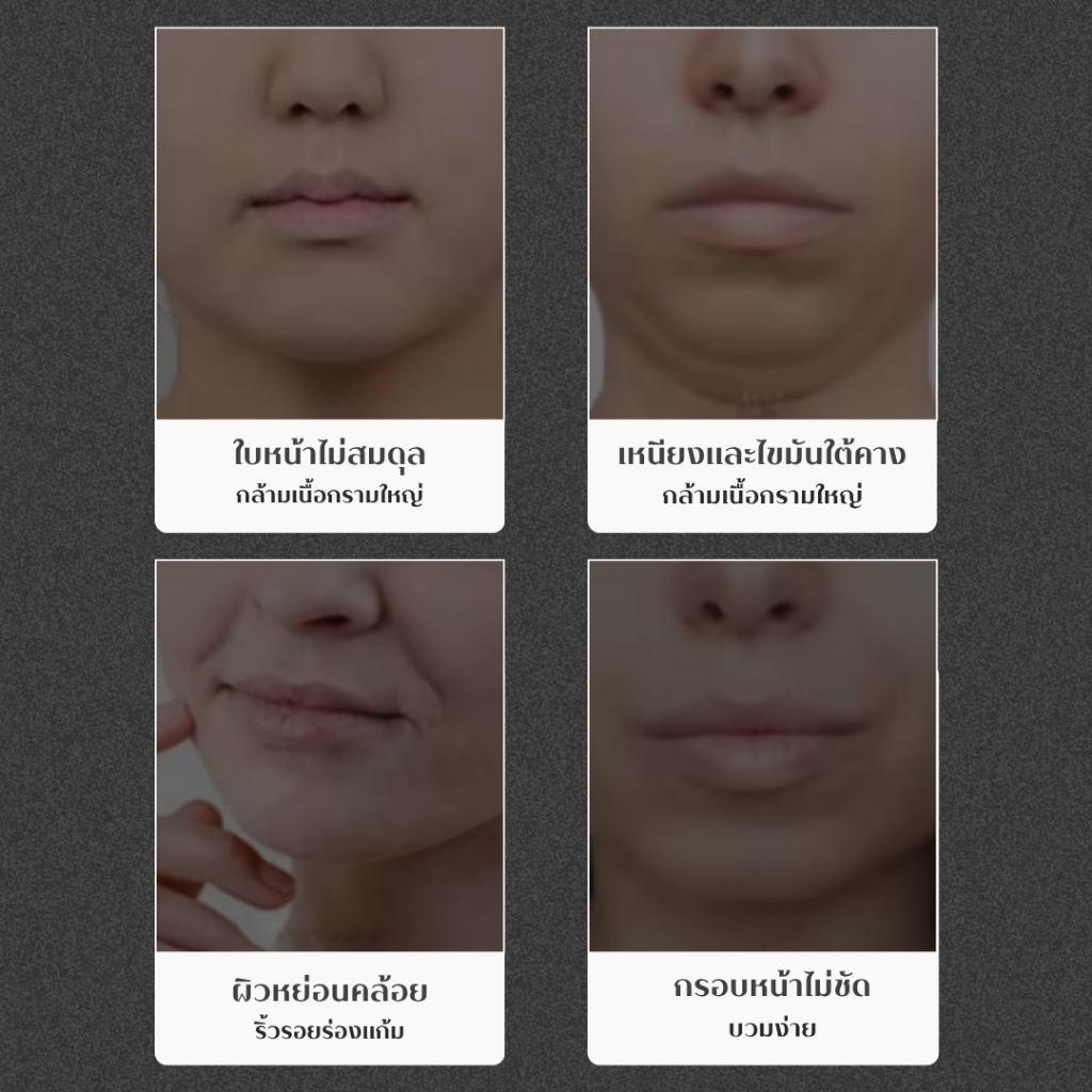 ⚡️พร้อมส่ง⚡️ สายรัดหน้า V Shape เข็มขัดยกกระชับ สายรัดคาง เทปพันหน้า ผ้าพันแผลหน้า สายรัดแก้ม มาส์กยกกระชับ ใบหน้า