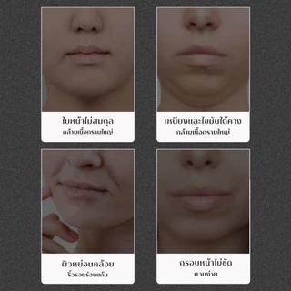 YIYIHOME สายรัดหน้า V Shape เข็มขัดยกกระชับ สายรัดคาง เทปพันหน้า ผ้าพันแผลหน้า สายรัดแก้ม มาส์กยกกระชับ ใบหน้า