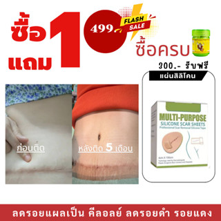ส่งไว!!!ซื้อ5แถม1++South Moonเทปซิลิโคนเจลรักษารอยแผลเป็น แผ…