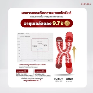 อาหารเสริม Celvita ย้อนวัยได้ โปร 2 กล่อง