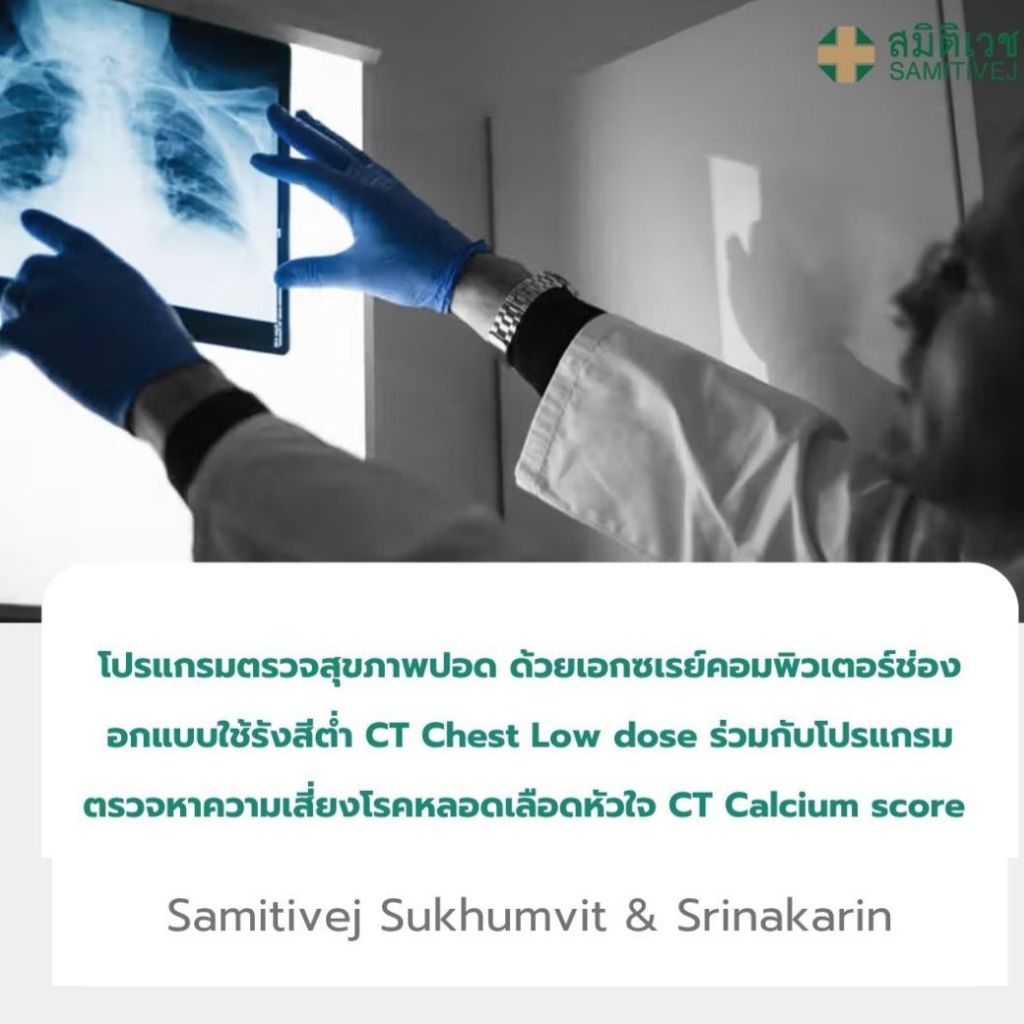 ตรวจสุขภาพปอด ด้วยเอกซเรย์คอมพิวเตอร์ช่องอก CT Chest Low dose ร่วมกับตรวจหาความเสี่ยงโรคหลอดเลือดหัวใจ CT Calcium score