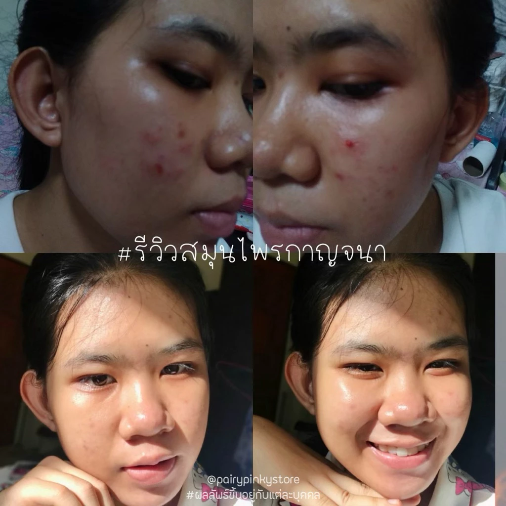 (พร้อมส่ง✅พาร์ทเนอร์บริษัท) สมุนไพรกาญจนา สมุนไพรไทย มาร์กสมุนไพร มาส์กสมุนไพร thumbnail 6