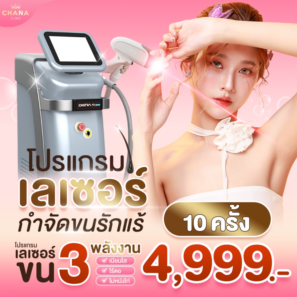 Chana Clinic เลเซอร์กำจัดขนรักแร้ 10 ครั้ง