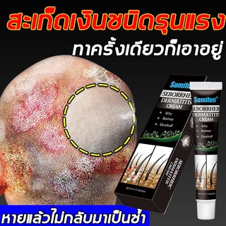 ครีมลดอาการคัน 20g ทาแก้คัน ผิวหนังทากากเกลื้อน สารสกัดจากพืชใช้ได้ กลากเกลื้อน สะเก็ดเงิน สิวที่หลัง เชื้อรา