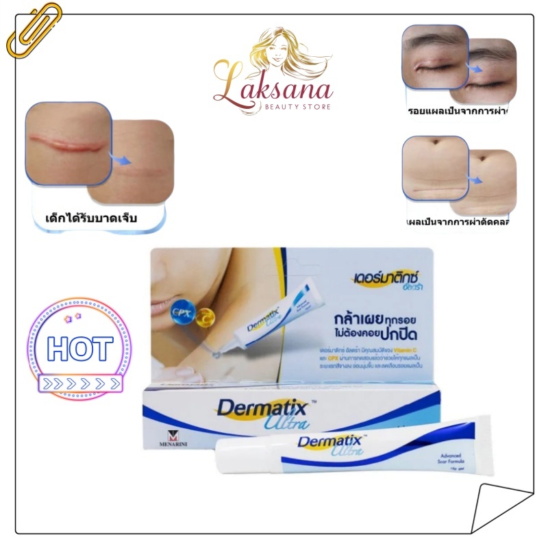 Dermatix Ultra Gel Concave convex Scar Scar Acne Mark 15g