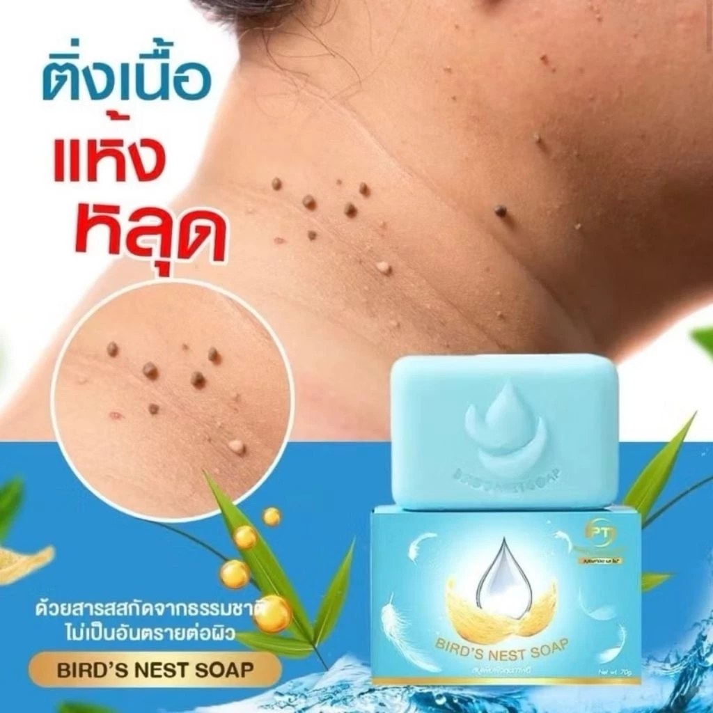 สบู่รังนกWP ติ่งเนื้อ คัน รังแค ขี้ไคลหนา 70g.​ส่งไว