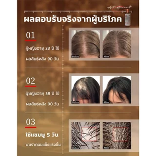 ⚡ของแท้⚡แชมพูปลูกผม แชมพูแก้ผมร่วง แชมพูขิง บำรุงหนังศีรษะ สดชื่น อ่อนโยน ไม่ระคายเคือง เร่งการเติบโตของผม ป้องกันผมร่วง