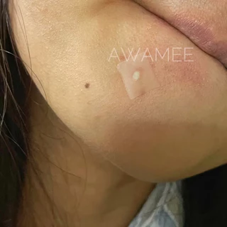(มีส่งด่วน)แผ่นแปะดูดสิวลายดาวใส ไฮโดรคอลลอยด์แท้