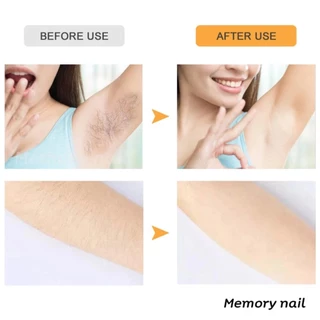ชุดเครื่องแว็กซ์ขน Pro Wax100 พร้อมเม็ดแว็กซ์และไม้พาย – แว็กซ์ร้อนใช้งานง่าย ถอนขนลึกถึงราก ผิวเนียนนาน