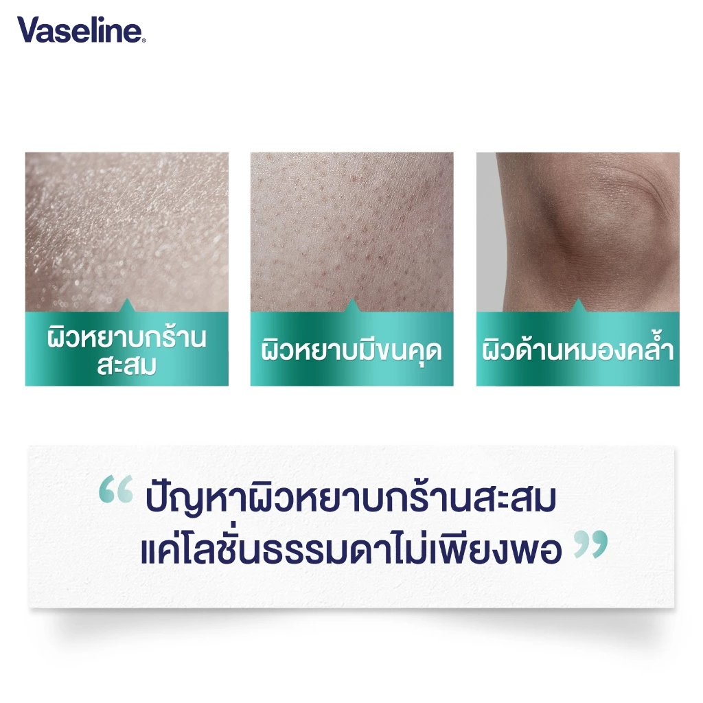 วาสลีน Pro Derma Body Ampoule Lotion 465ml แพ็คคู่ ผิวชุ่มชื้น thumbnail 10
