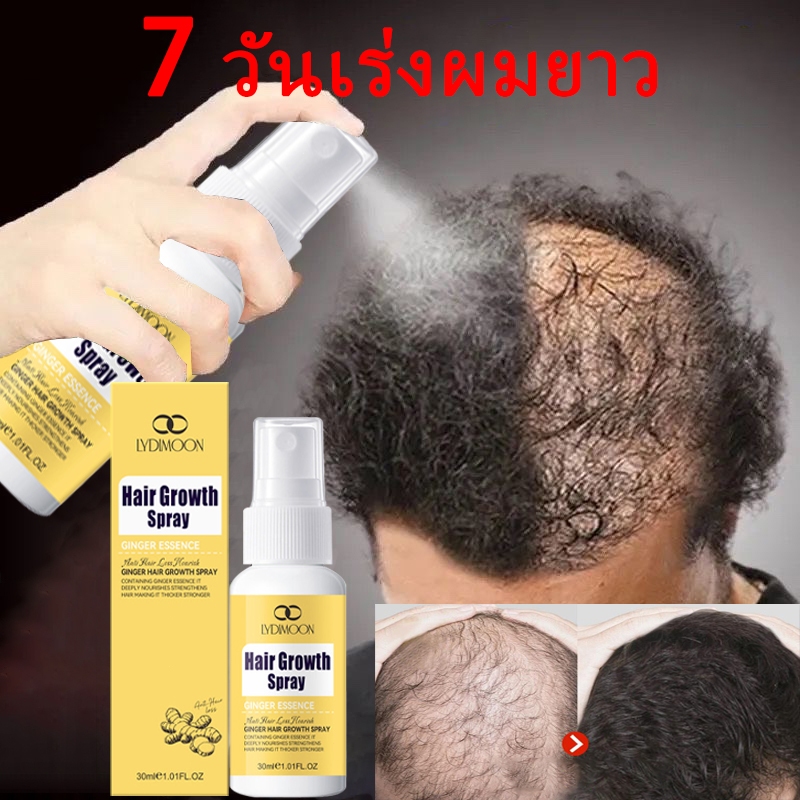 สเปรย์ปลูกผม สเปรย์ปลูกผมดก น้ำยาเร่งผมยาว 30ml ลดผมร่วง ปลูกผม บำรุงเส้นผม ผมยาว ช่วยผมเกิดใหม่