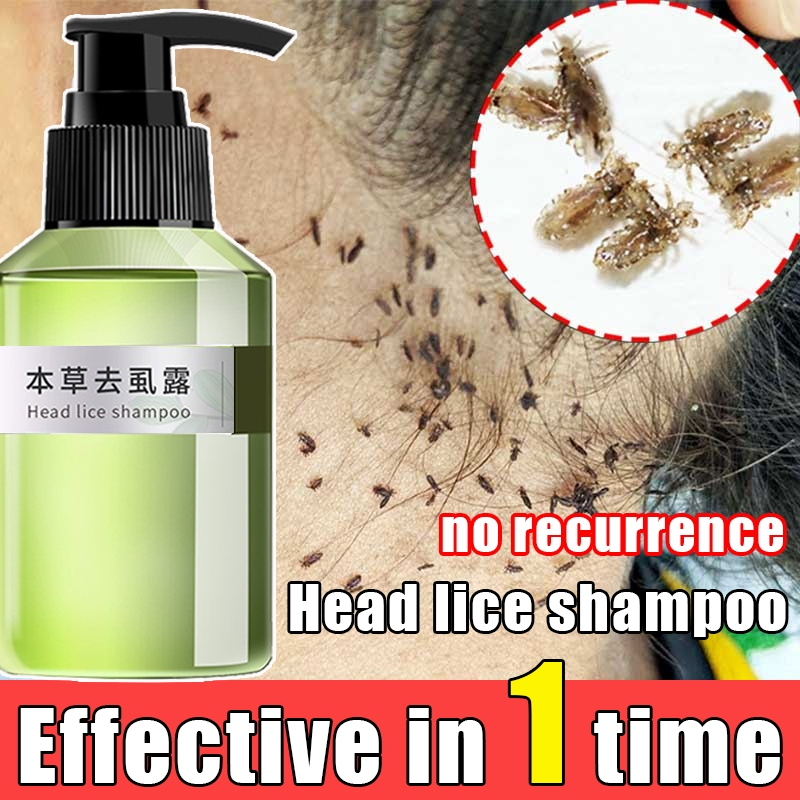 แชมพูกำจัดเหา ยาสระแก้เหา ออแกนิค แชมพูเด็ก กลิ่นหอม เห็นผลจริง ไข่เหา ตัวเหา ยาฆ่าเหา แก้คันเหากัดหัว 100ml