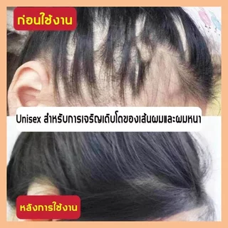 ซื้อ 1 แถม 1สินค้านำเข้าPEIMEI แชมพูแก้ผมร่วง แชมพูสมุนไพรขิงบำรุงผม250ml แชมพูปลูกผม ยาสระผมแก้ร่วง แชมพูขิงเพียว แชมพู