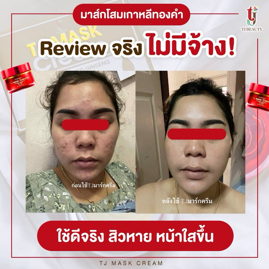 มัดโปรtjmaskทีเจมาส์กครีมโสมเกาหลีทองคำสูตรต้นตำหรับ ลดฝ้ากระหน้าขาวใสบำรุงผิวหน้า*นำเข้าจากเกาหลี