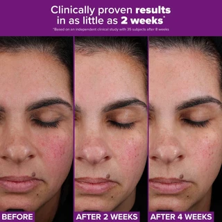 Paula's Choice PRO Retinaldehyde Treatment พอลล่าส์ ช้อยส์ โปร เรตินอลดีไฮน์ ทรีตเมนต์