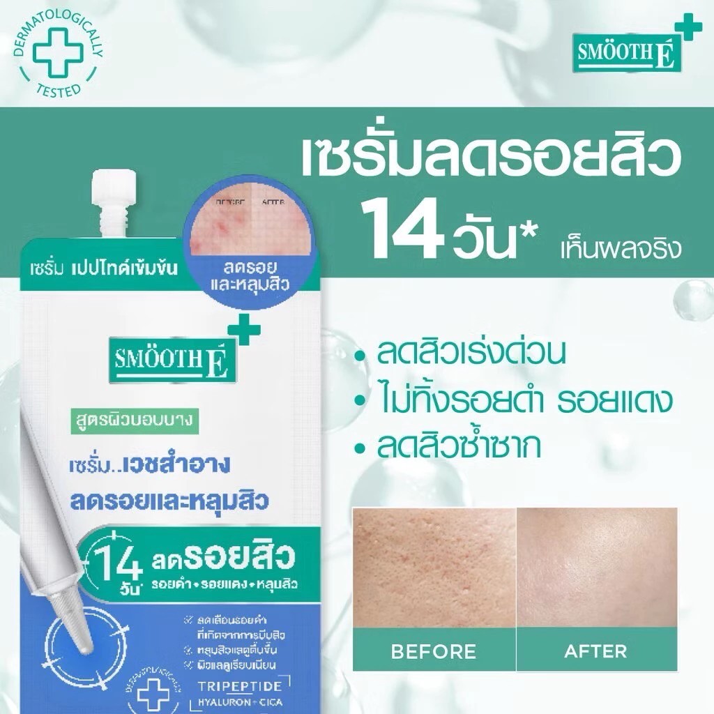 Smooth E Smooth  เจลแต้มสิว และ ลดรอยสิว สมูท อี แบบซอง 2 สูตร