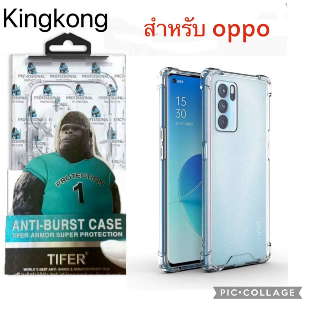 เคสใส กันกระแทก คิงคอง สำหลับ OPPO  A73 A74 4g-5G] A76 A77 5G] A77s A78 4g-5g A79