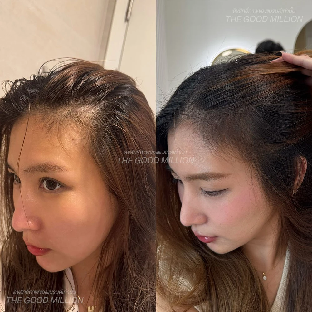 Hair Serum เซรั่มบำรุงผม นวัตกรรม 3 สูตรเพื่อผมสวยครบมิติ ฟื้นฟูผม เร่งผมยาว ผมหนา ผมสวย โคนจรดปลาย thumbnail 7